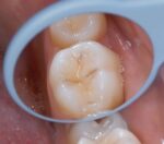 آینه رادیومی ریلکس هانینکرات Hahnenkrat Relax FS Rhodium - تصویر 3