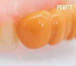 واش قالبگیری لایت بادی VinciSmile PERFIT Light Body - تصویر 8