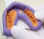 پوتی قالبگیری A سیلیکونی VinciSmile PERFIT Putty - Image 3